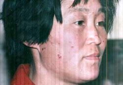 图：赵凤英被宋树灵用烟头烫烧后第三天被劫回当地，在红沙沟派出里警察给照的照片。