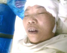 陈玉梅被恶警打成重伤后在医院的照片