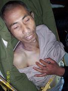 自2009年2月25日被绑架到2009年10月25日被迫害致死，年仅46岁的黄立忠被折磨得皮包骨、伤痕累累。