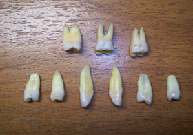 图为张惠强迫害松动脱落后保留下来的牙，还有一些在狱中被警察搜号时给搜走了。