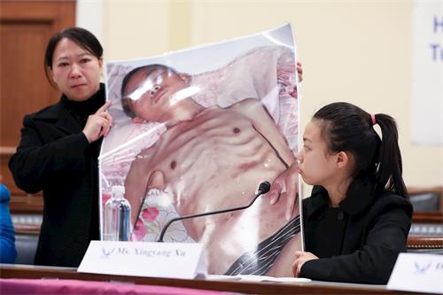 '图4：今年十七岁的徐鑫洋和妈妈迟丽华在美国国会展示了一幅她的爸爸徐大为被中共迫害得瘦骨嶙峋，满身伤痕，奄奄一息的照片。'