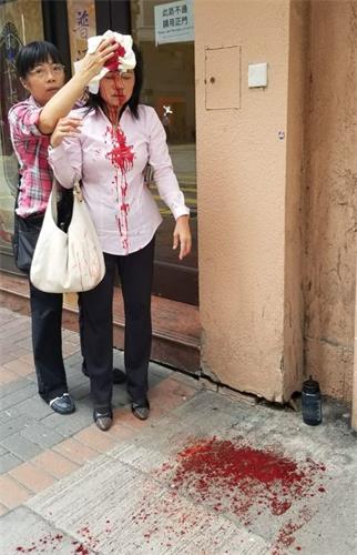 '图：二零一九年九月二十四日下午约四点左右，法轮功学员廖秋兰在长沙湾警署附近被袭击，头部受伤。'