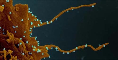 '图2：细胞被武汉肺炎（新冠病毒）感染后形成大量释放病毒的伪足（示意图，白色颗粒示病毒颗粒，图片自Elizabeth Fischer， Microscopy Unit NIH/NIAID.）'