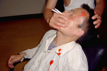 酷刑演示：将两根烟同时点着插入法轮功学员的鼻孔，把嘴捂住。熏呛、窒息，极为痛苦