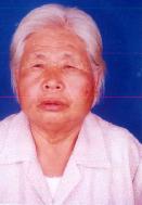 郭福香老人被暴打后，脸部红肿、带血痕的照片。