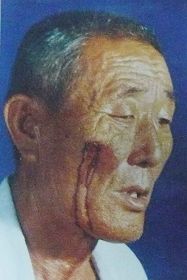 付文庆的老父亲脸上留下疤痕