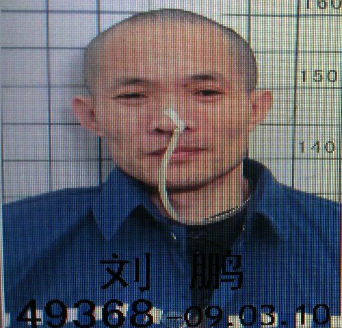 图为上海法轮功学员刘鹏被“强制灌食”酷刑折磨的惨状