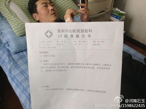 '被警察殴打后住在医院的律师张俊杰，医生诊断腰椎三处骨折'