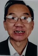 油画专家韩以明的牙齿被打断几颗
