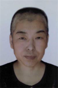 李国俊被迫害化疗后的照片