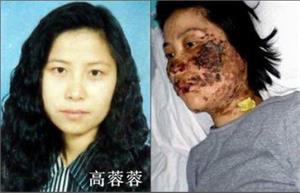 '高蓉蓉被迫害前被电击后毁容的脸'