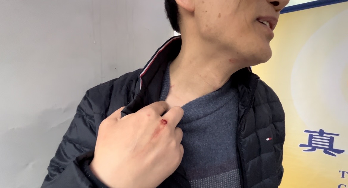图3：法轮功学员David Fang于二月十六日下午，遭齐中平暴力攻击，导致流血，手背、脖子、下巴都有伤痕。（法轮功学员提供）