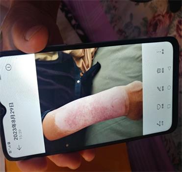 '图4:正念对待后的如今状态'