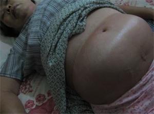'刘晓莲被迫害得全身浮肿、奄奄一息'